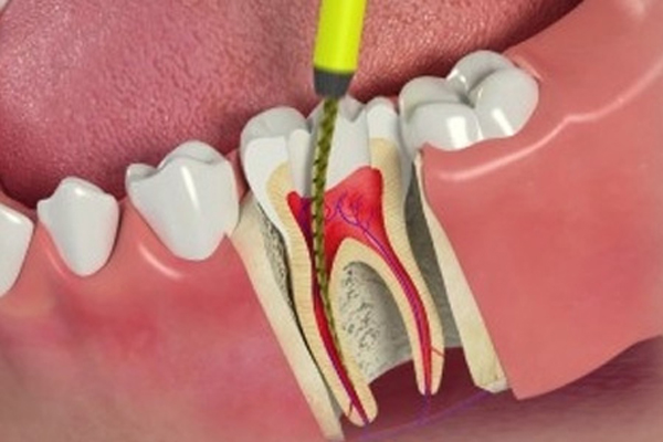 Endodontia